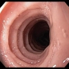 Desórdenes eosinofílicos: Primera parte