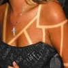 Sunburn art: Peligros de tatuarse al sol